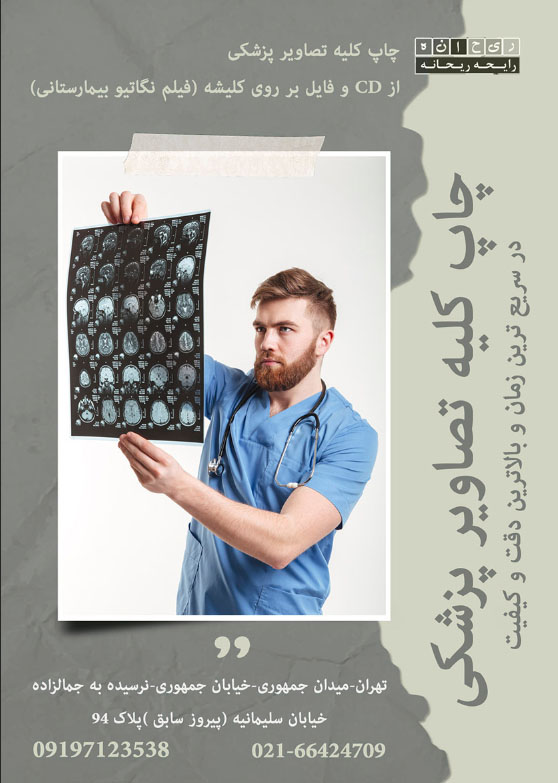 «مرکز چاپ سیدی MRI و CT Scan در تهران»