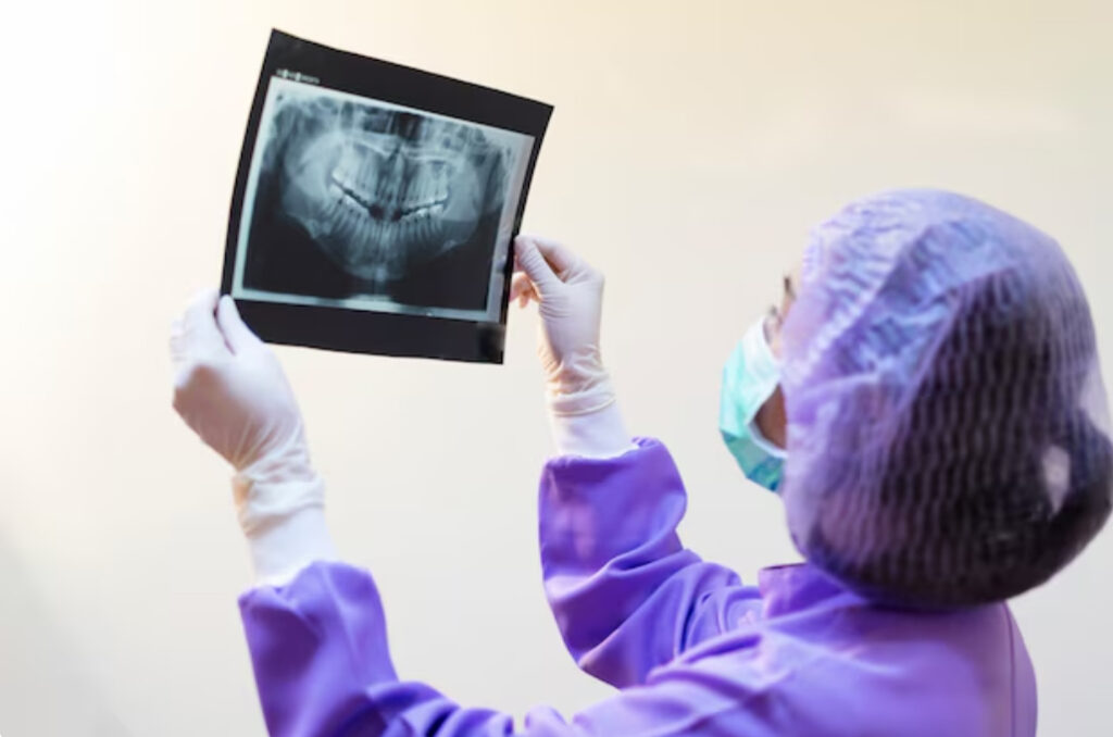 چاپ تصاویر OPG در مرکز رایحه ریحانه