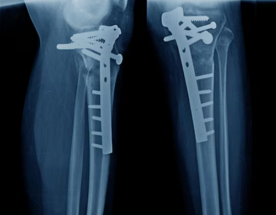 چاپ تصاویر پزشکی رایحه ریحانه