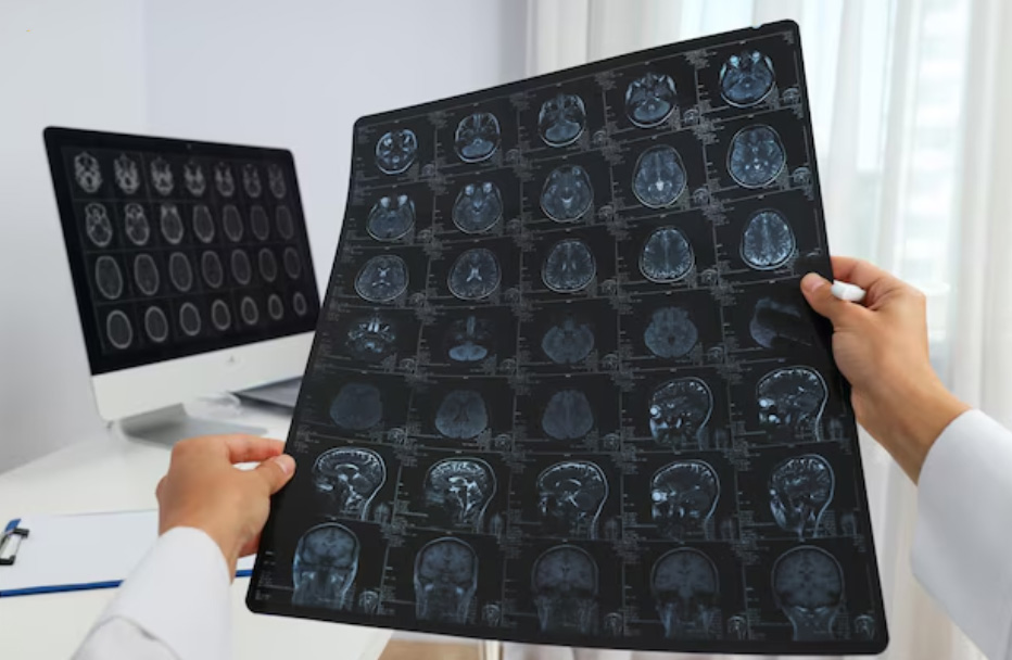 کلیشه بیمارستانی