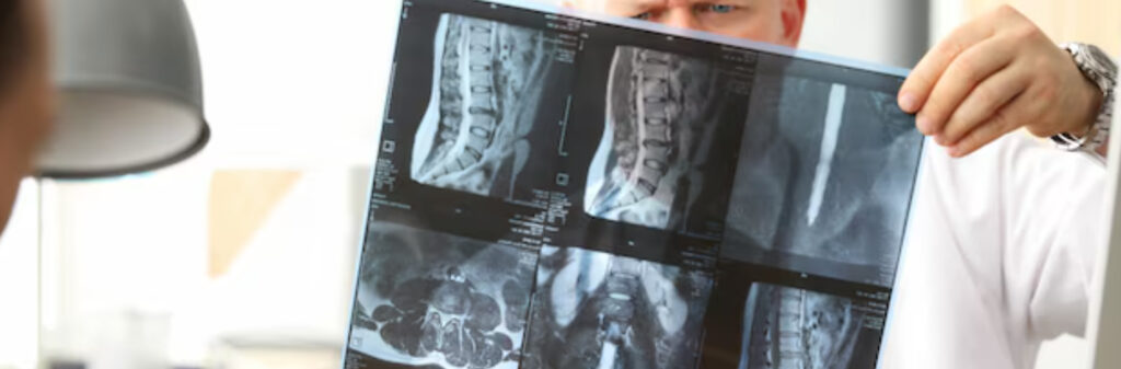 چاپ سی‌دی ام‌آر‌آی (چاپ CD MRI)