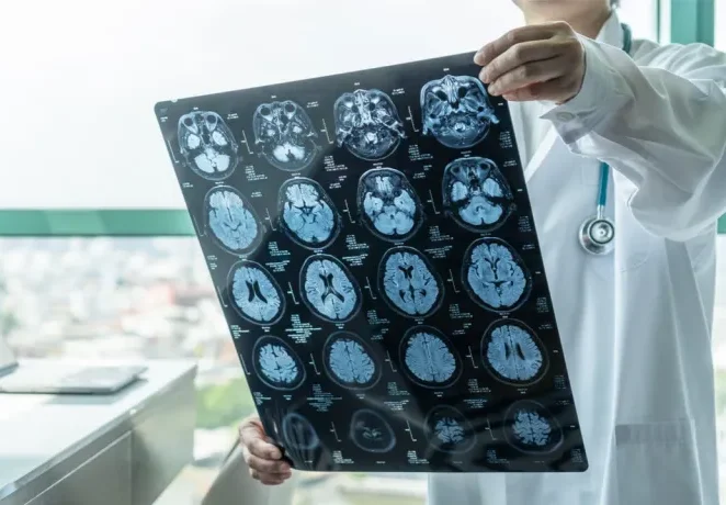 MRI فیلم نگاتیو