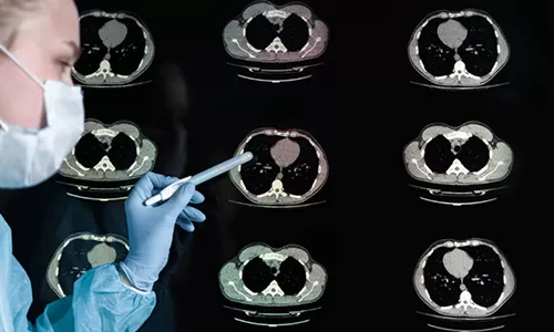 چاپ تصاویر پزشکی رایحه ریحانه